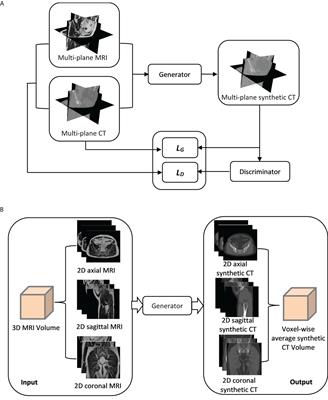 Synthetic CT generation for MRI-guided adaptive radiotherapy in prostate cancer